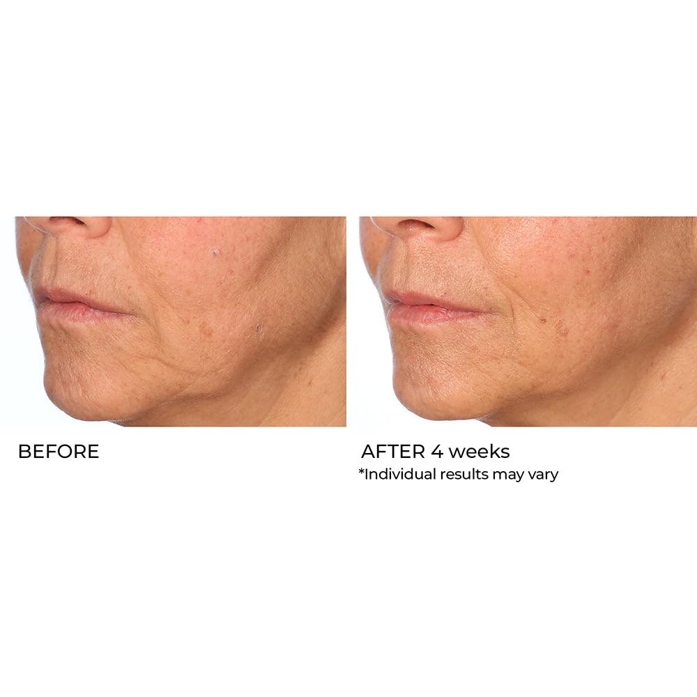 image:imageNassifMD Radiance Booster Vitamins C for Face Brightening serum Dark Spot Remover Vitamin C with Omega3 and Squalene Oil