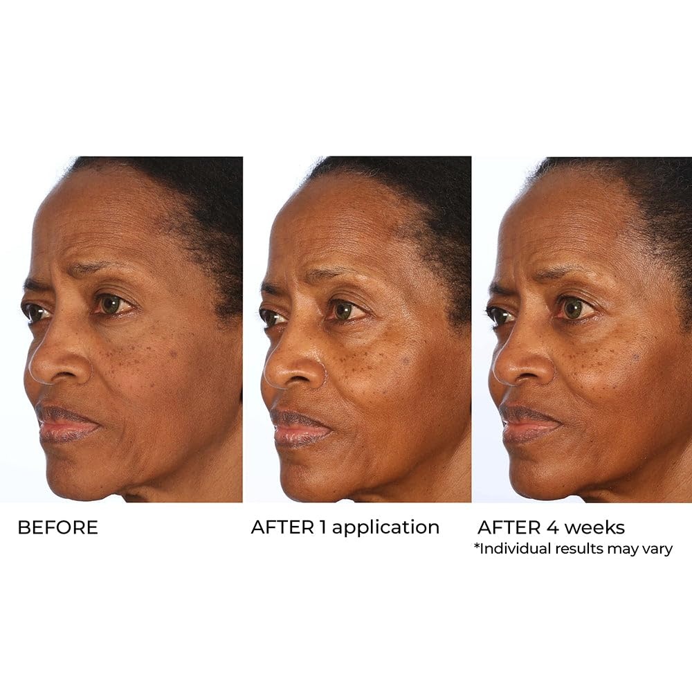 image:imageNassifMD Radiance Booster Vitamins C for Face Brightening serum Dark Spot Remover Vitamin C with Omega3 and Squalene Oil