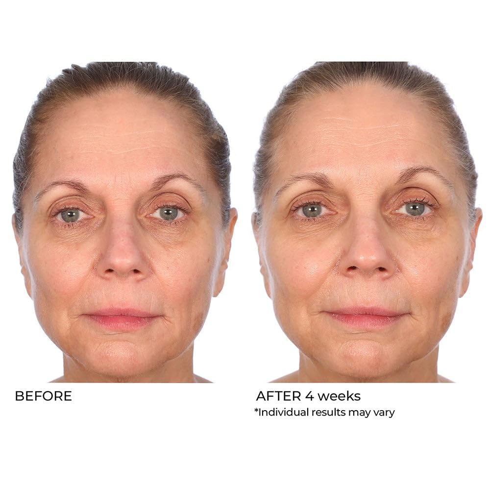 image:imageNassifMD Radiance Booster Vitamins C for Face Brightening serum Dark Spot Remover Vitamin C with Omega3 and Squalene Oil