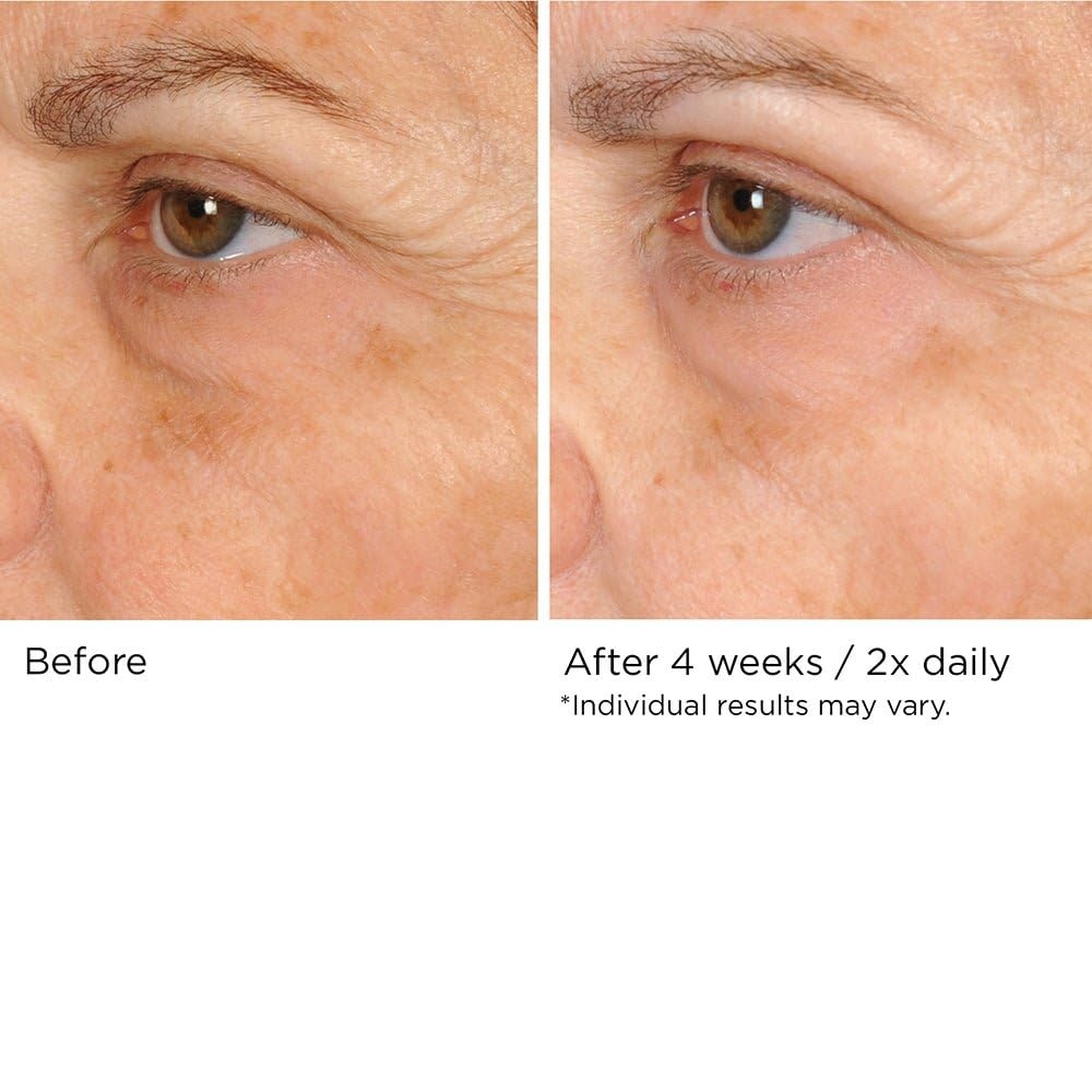 image:imageNASSIFMD PeriOrbital Under Eye Cream for Wrinkles Under Eye Cream Dark Circles and Puffiness Under Eye Dark Circles Treatment Eye Wrinkle Cream Dark Eyes Circle Treatment