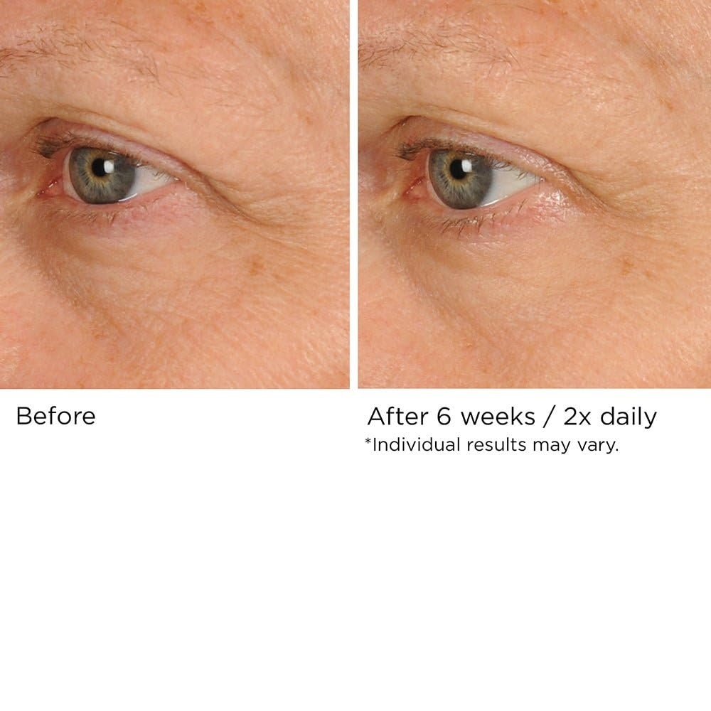 image:imageNASSIFMD PeriOrbital Under Eye Cream for Wrinkles Under Eye Cream Dark Circles and Puffiness Under Eye Dark Circles Treatment Eye Wrinkle Cream Dark Eyes Circle Treatment