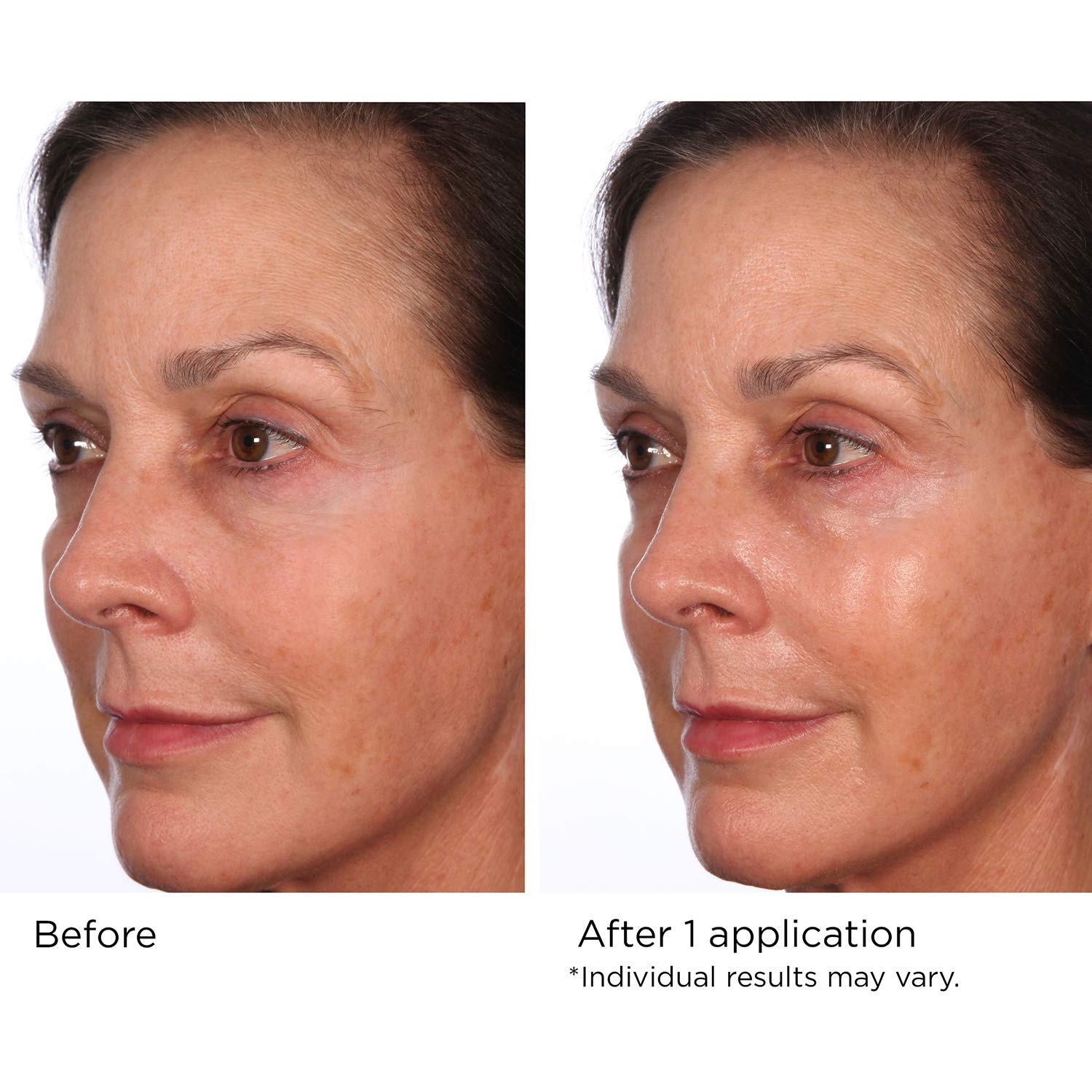 image:imageNASSIFMD Pure Hydration Targeted Face Moisturizer AntiAging Hydrating Cream for Day or Night Soft Focus Pore Blurring or Pure Hydration Rejuvenating Overnight RepairNight Cream