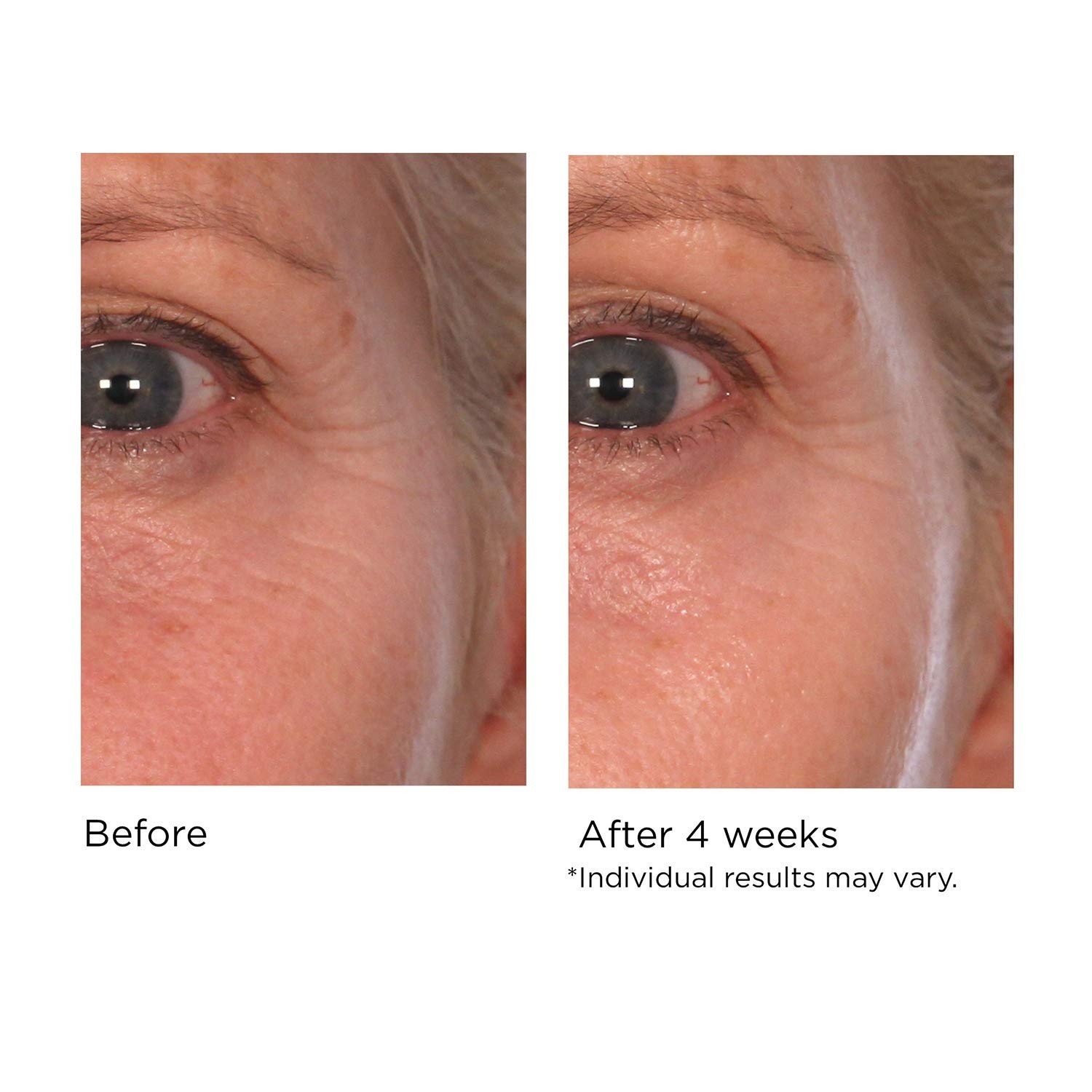 image:imageNASSIFMD Pure Hydration Targeted Face Moisturizer AntiAging Hydrating Cream for Day or Night Soft Focus Pore Blurring or Pure Hydration Rejuvenating Overnight RepairNight Cream