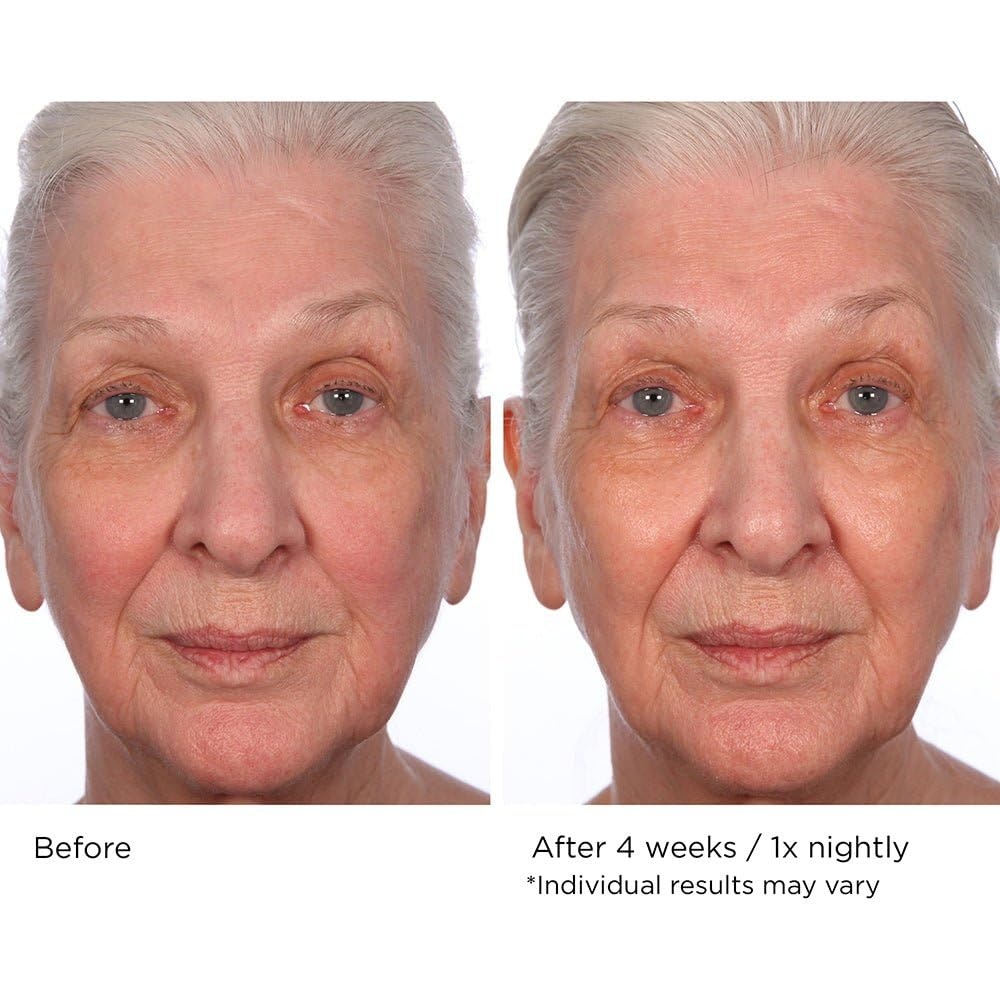 image:imageNASSIFMD Pure Hydration Targeted Face Moisturizer AntiAging Hydrating Cream for Day or Night Soft Focus Pore Blurring or Pure Hydration Rejuvenating Overnight RepairNight Cream