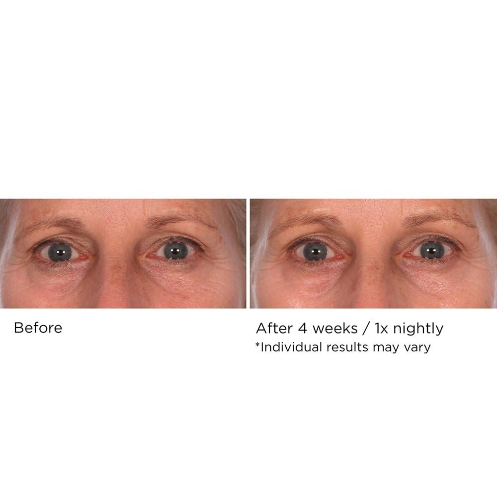 image:imageNASSIFMD Pure Hydration Targeted Face Moisturizer AntiAging Hydrating Cream for Day or Night Soft Focus Pore Blurring or Pure Hydration Rejuvenating Overnight RepairNight Cream