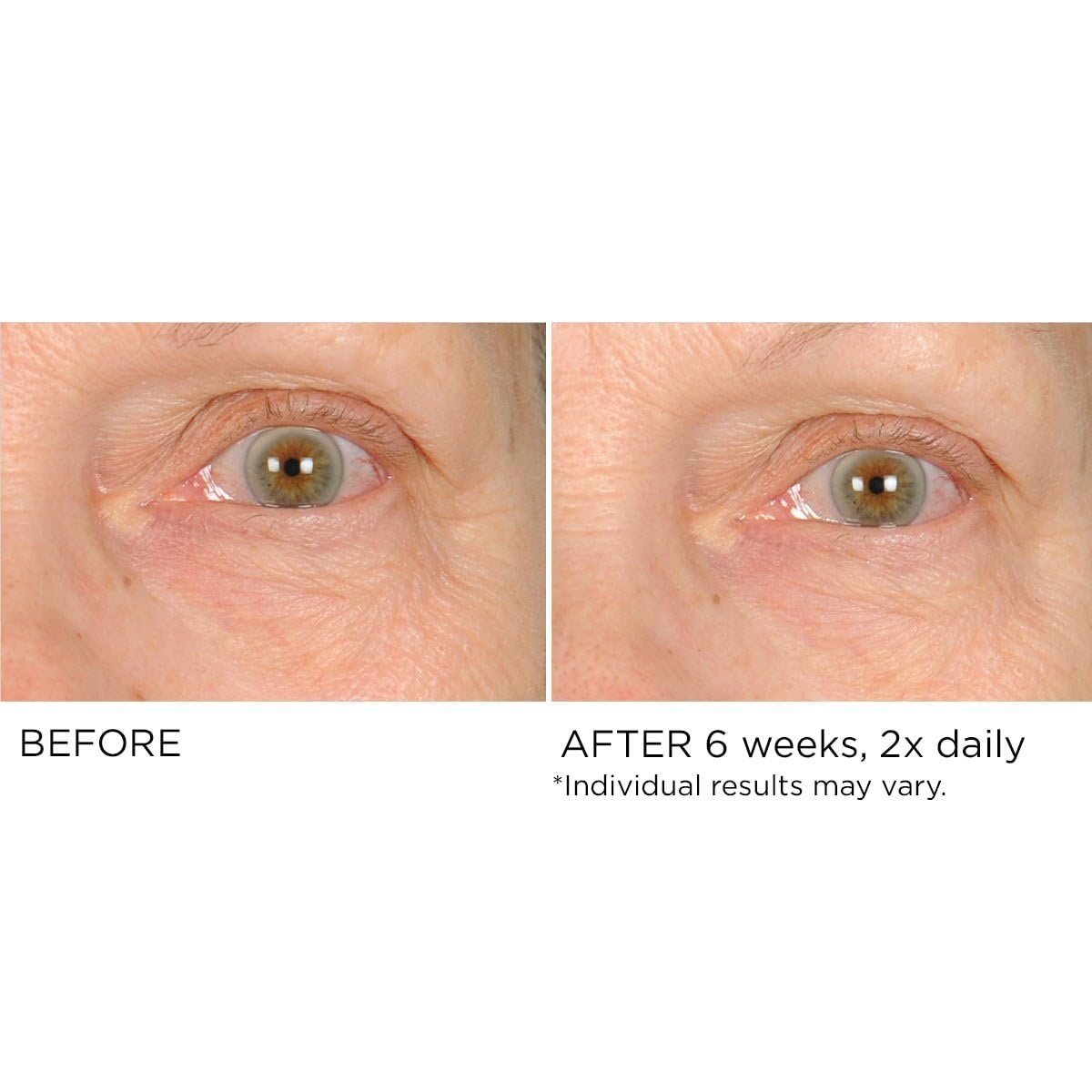image:imageNASSIFMD Under Eye Smoother Firming Cream AntiAging Eye Cream for Dark Circles Puffiness amp Wrinkles