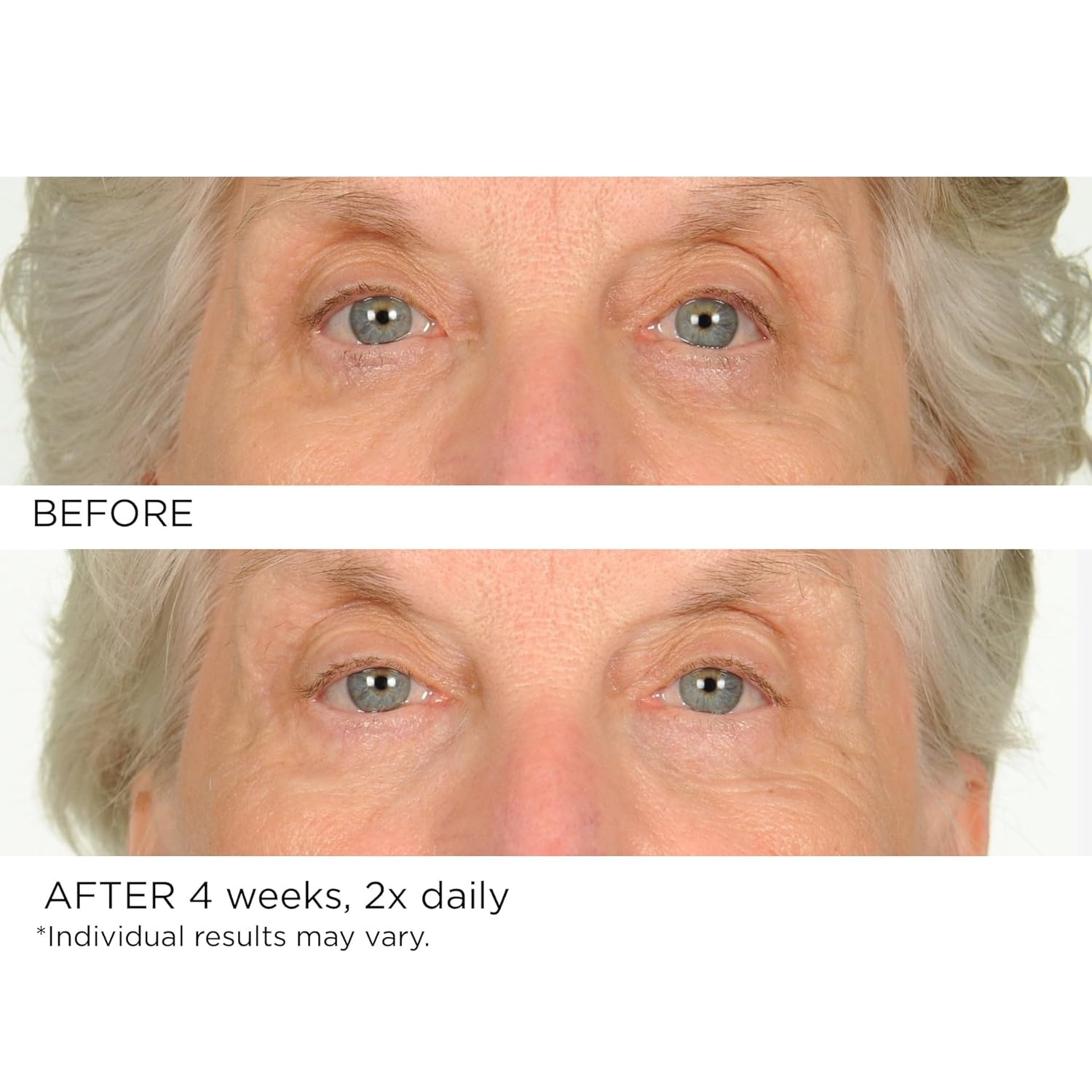 image:imageNASSIFMD Under Eye Smoother Firming Cream AntiAging Eye Cream for Dark Circles Puffiness amp Wrinkles