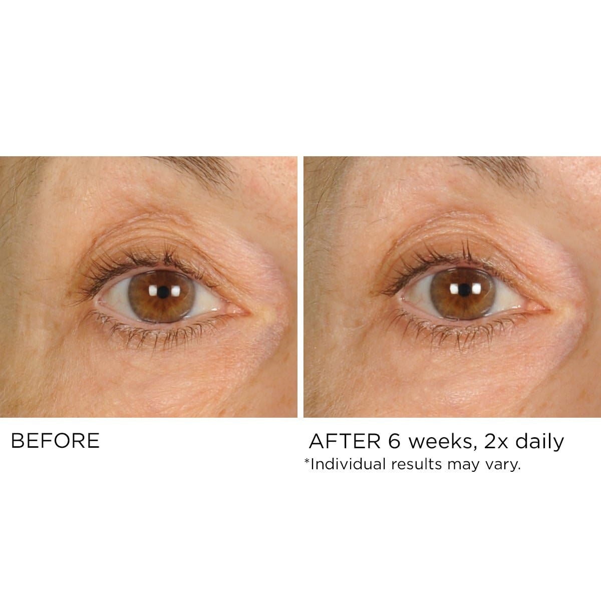 image:imageNASSIFMD Under Eye Smoother Firming Cream AntiAging Eye Cream for Dark Circles Puffiness amp Wrinkles