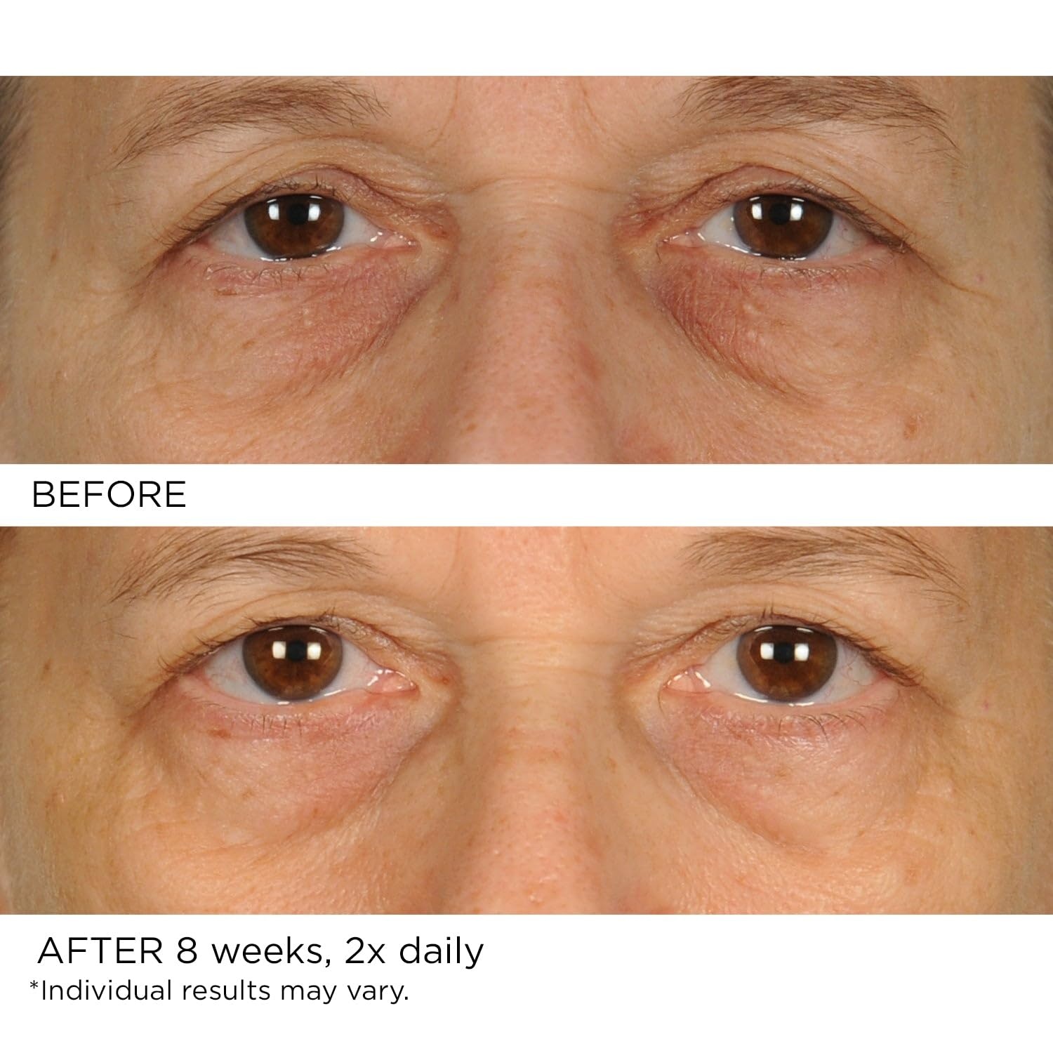 image:imageNASSIFMD Under Eye Smoother Firming Cream AntiAging Eye Cream for Dark Circles Puffiness amp Wrinkles