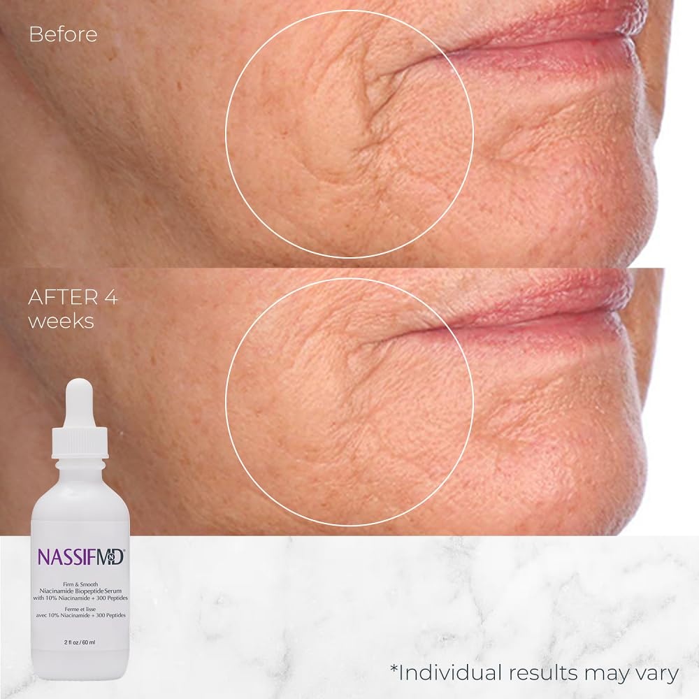 image:imageNassifMD 10 Niacinamide Serum with BioPeptides Brighten Firm amp Hydrate Skin While Reducing Fine Lines Wrinkles amp Uneven Texture