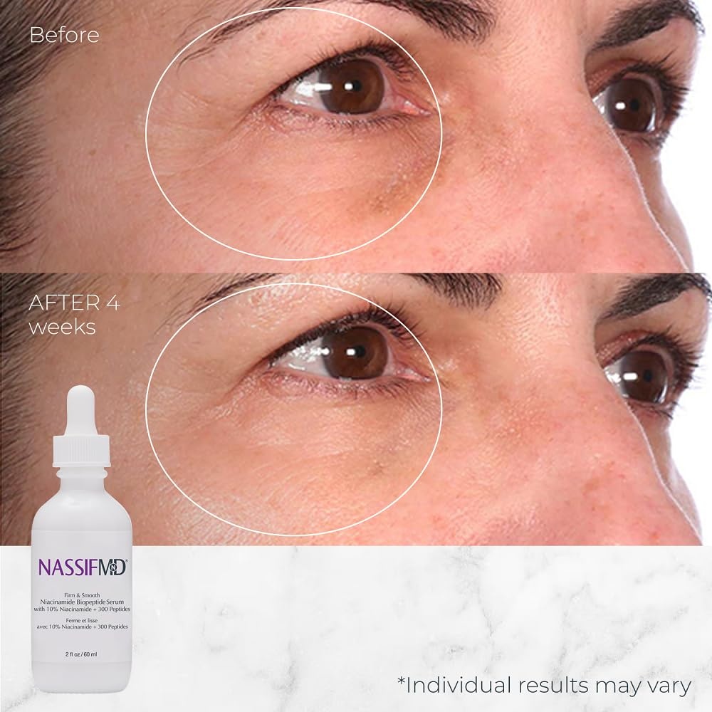 image:imageNassifMD 10 Niacinamide Serum with BioPeptides Brighten Firm amp Hydrate Skin While Reducing Fine Lines Wrinkles amp Uneven Texture
