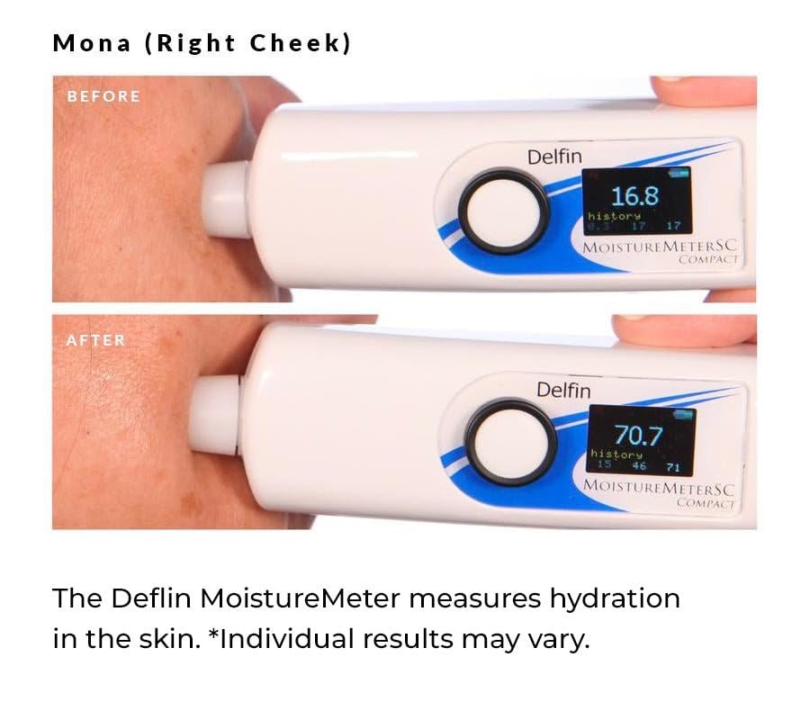 image:imageNassifMD 3HA Instant Hydrating Facial Mist Contains 3 Types of Hyaluronic Acid to Keep Your Face Refreshed and Hydrated Decreases Look of Skin Puffiness Dark Circles and Fine Lines4 Fl Oz Pack of 1