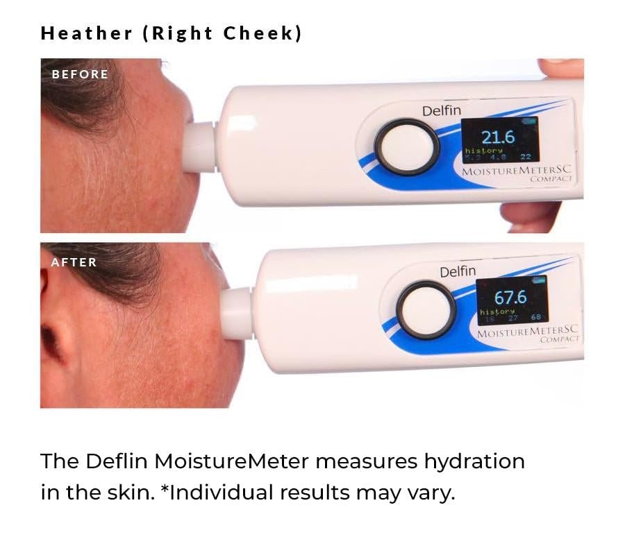 image:imageNassifMD 3HA Instant Hydrating Facial Mist Contains 3 Types of Hyaluronic Acid to Keep Your Face Refreshed and Hydrated Decreases Look of Skin Puffiness Dark Circles and Fine Lines4 Fl Oz Pack of 1