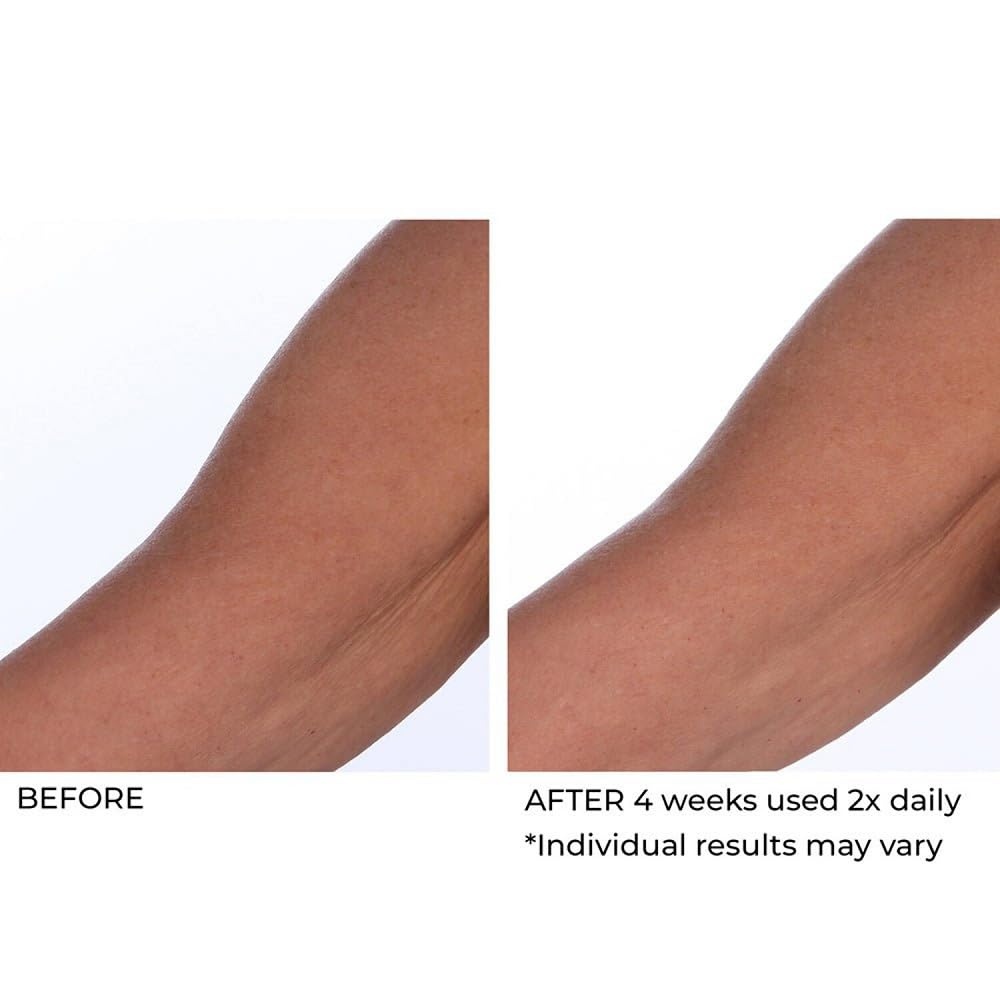 image:imageNassifMD Crepe Inhibitor Triple Action 8 Fl Oz