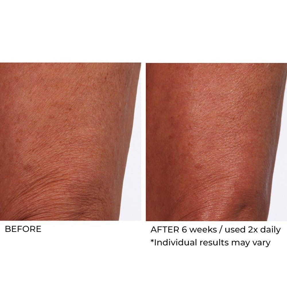 image:imageNassifMD Crepe Inhibitor Triple Action 8 Fl Oz