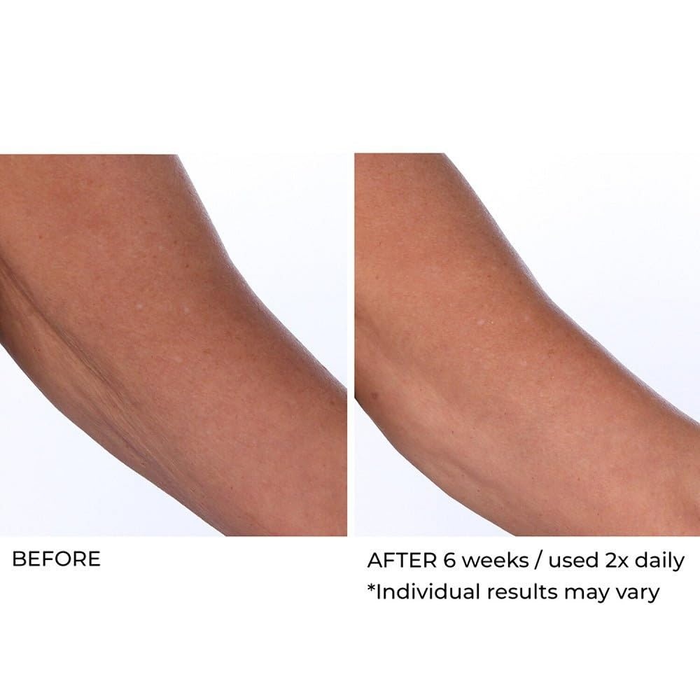 image:imageNassifMD Crepe Inhibitor Triple Action 8 Fl Oz