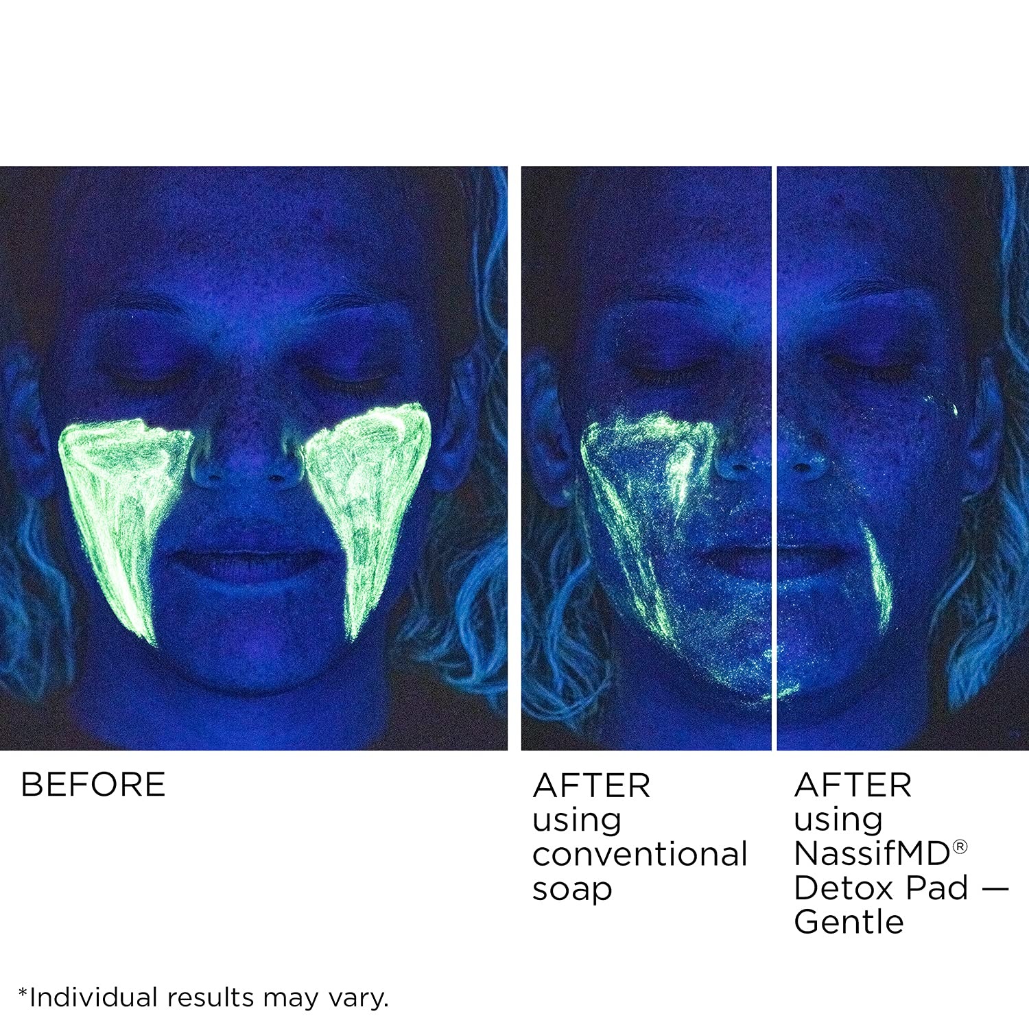image:imageNassifMD Gentle Detox Pads SurgeonCreated Fruit Acid Complex for Sensitive Skin Brightens Exfoliates amp Reduces Wrinkles DermatologistTested