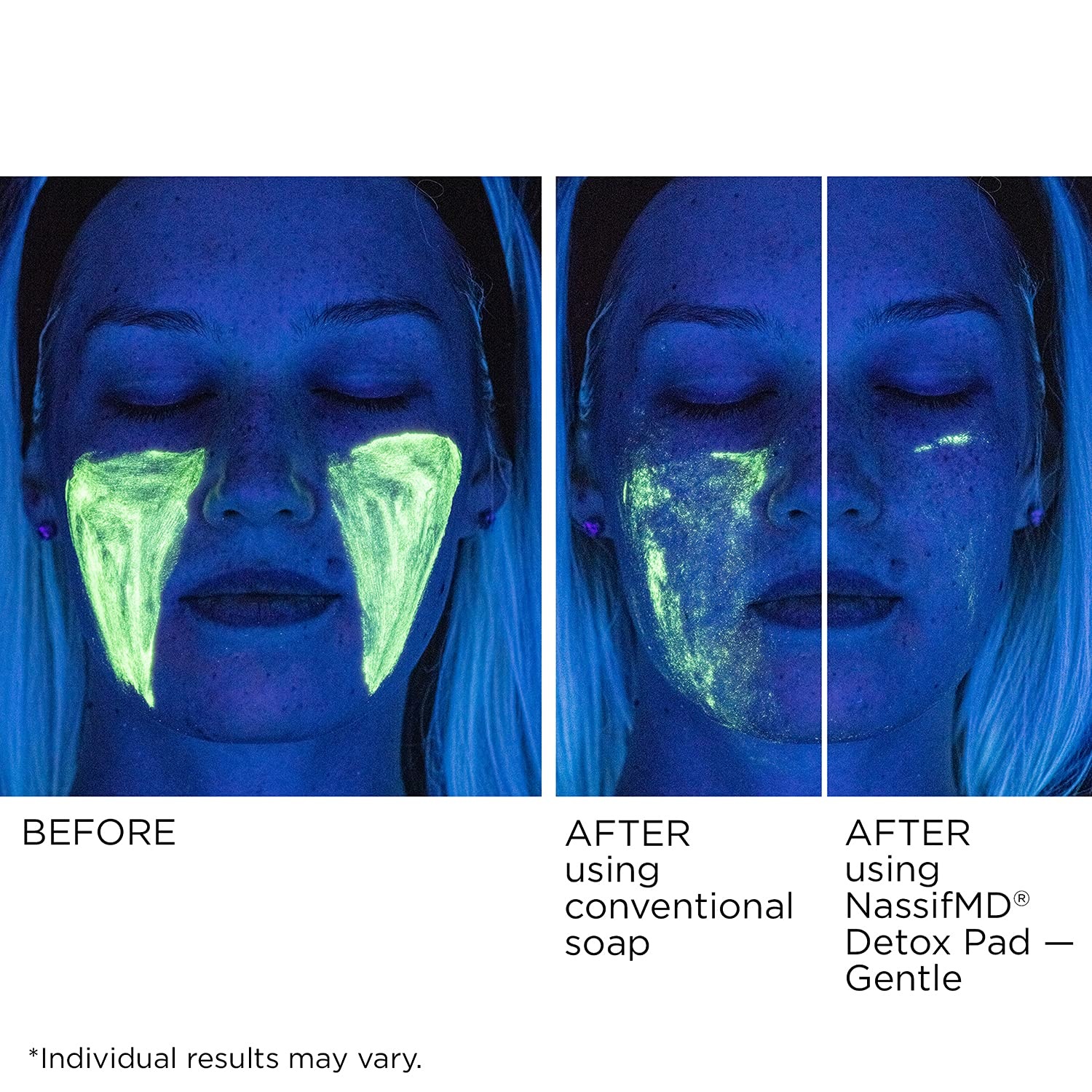 image:imageNassifMD Gentle Detox Pads SurgeonCreated Fruit Acid Complex for Sensitive Skin Brightens Exfoliates amp Reduces Wrinkles DermatologistTested