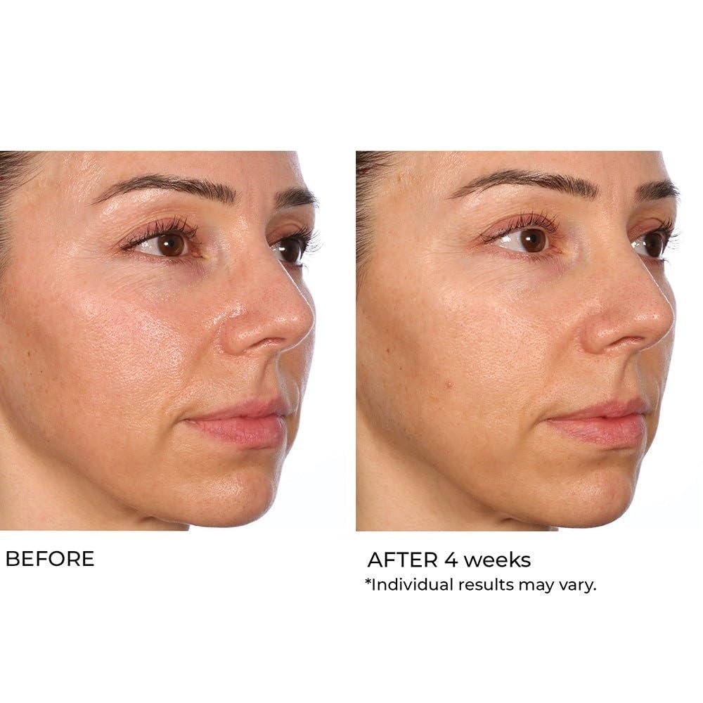 image:imageNassifMD HydroGel with Hylauronic Acid Moisturizer Salicylic Acid Serum Retinol Serum for Face