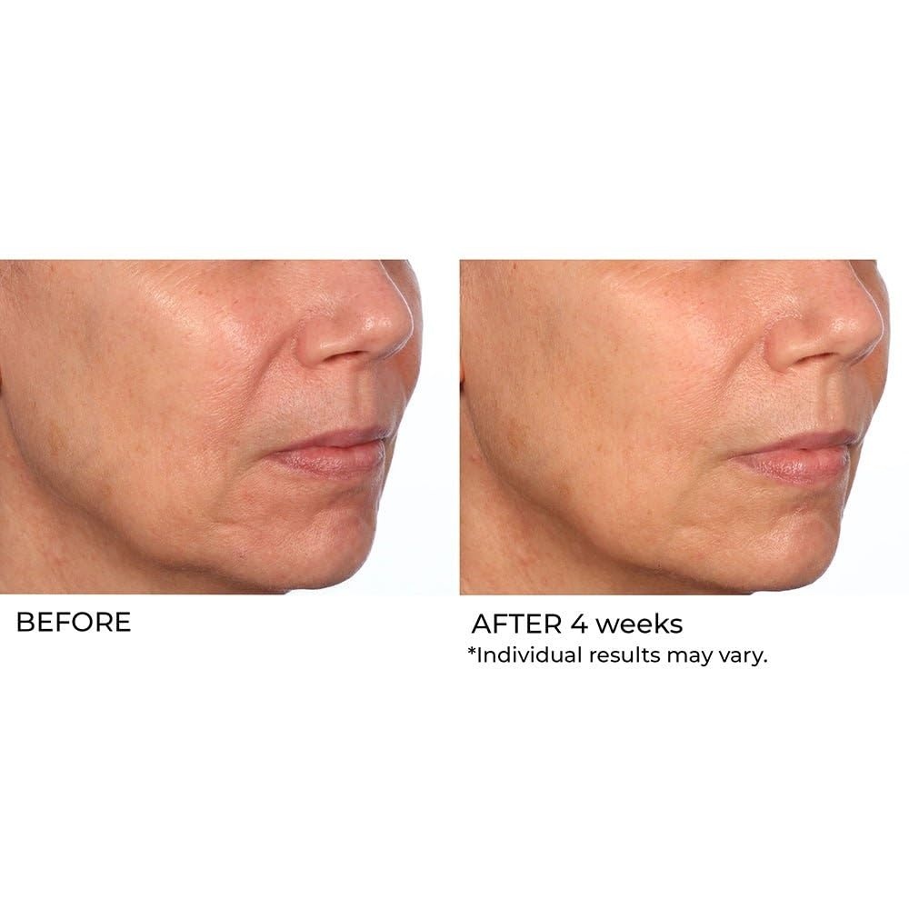 image:imageNassifMD HydroGel with Hylauronic Acid Moisturizer Salicylic Acid Serum Retinol Serum for Face
