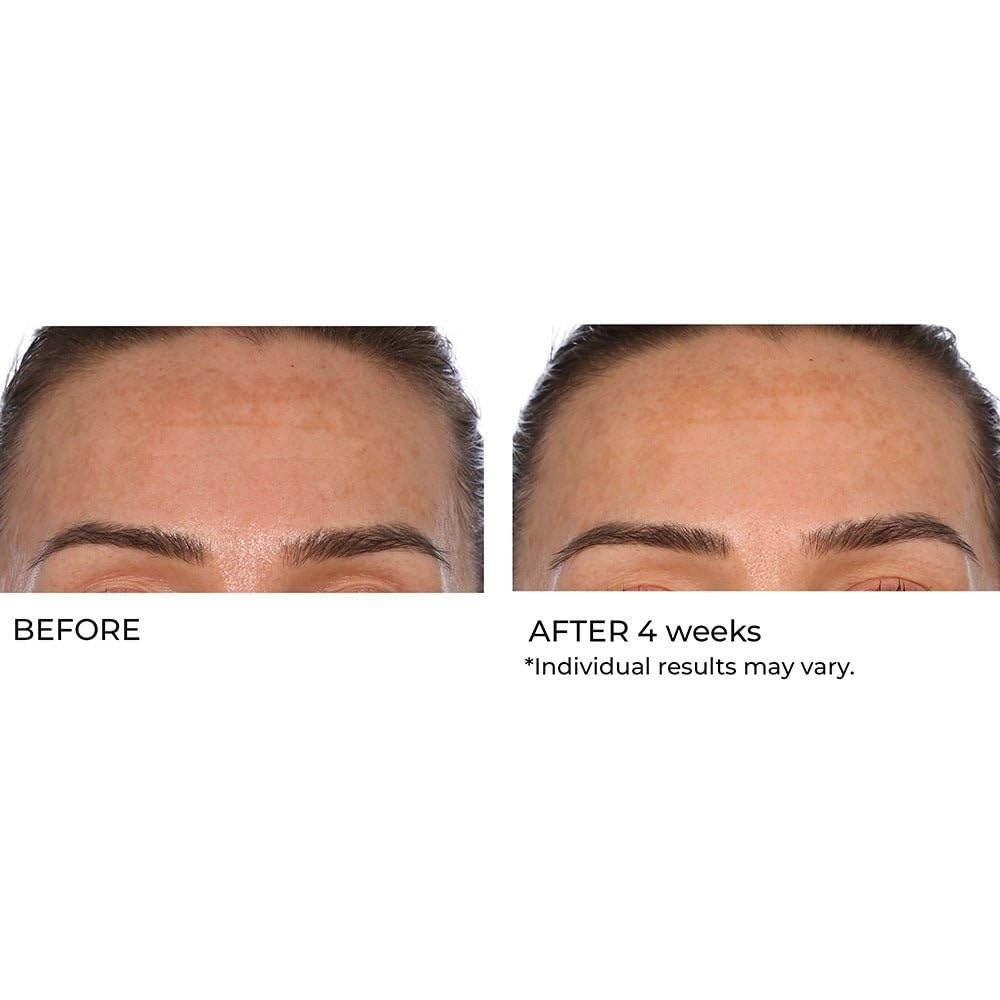 image:imageNassifMD HydroGel with Hylauronic Acid Moisturizer Salicylic Acid Serum Retinol Serum for Face