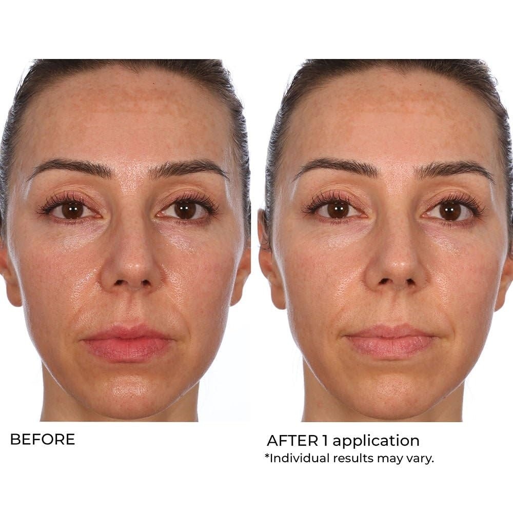 image:imageNassifMD HydroGel with Hylauronic Acid Moisturizer Salicylic Acid Serum Retinol Serum for Face