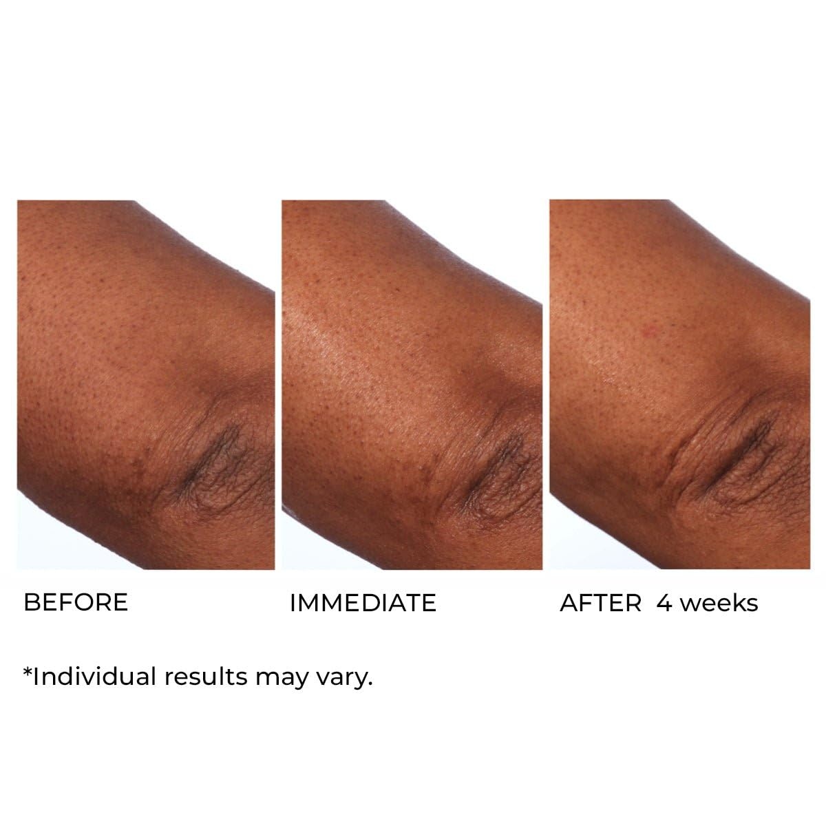 image:imageNassifMD HydroScreen Intense Hydration Face And Body SouffleJar