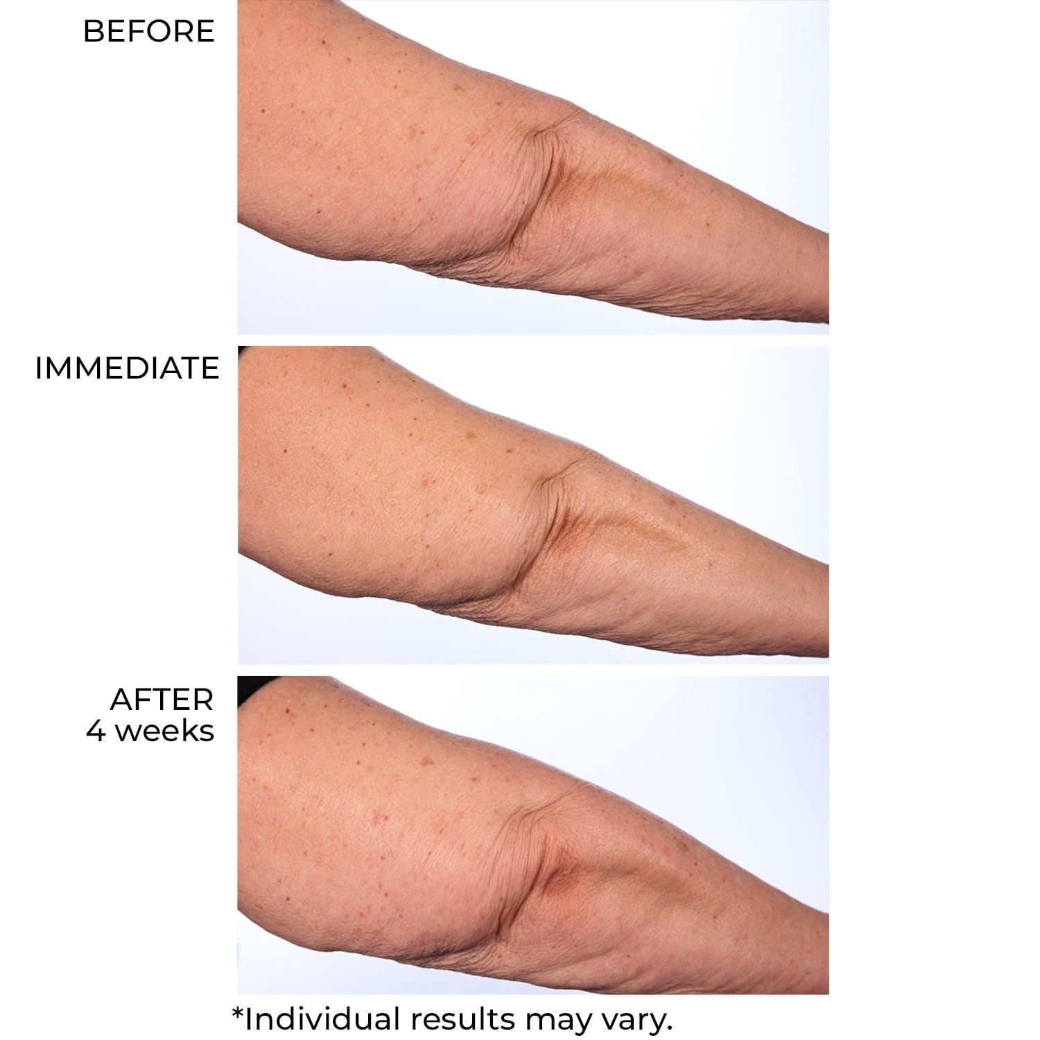 image:imageNassifMD HydroScreen Intense Hydration Face And Body SouffleJar