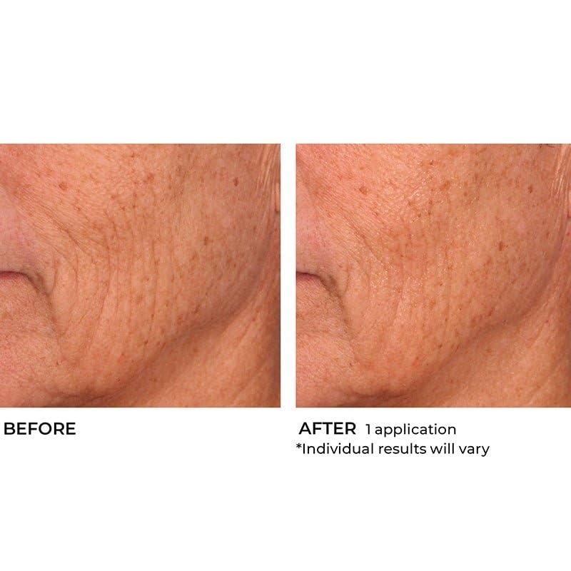 image:imageNassifMD HydroScreen Intense Hydration Face And Body SouffleJar