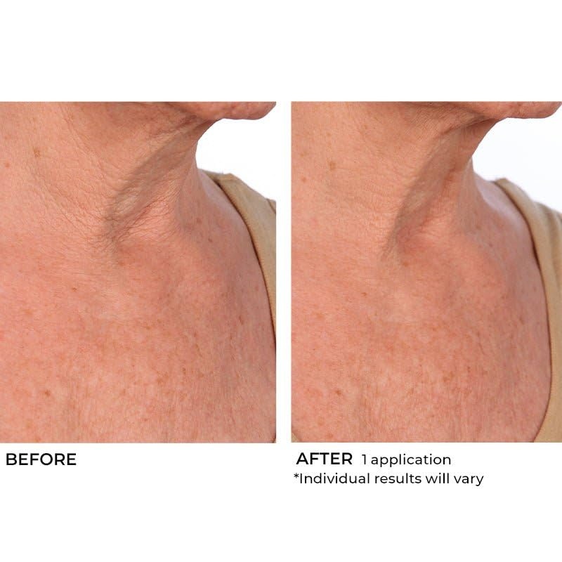 image:imageNassifMD HydroScreen Intense Hydration Face And Body SouffleJar