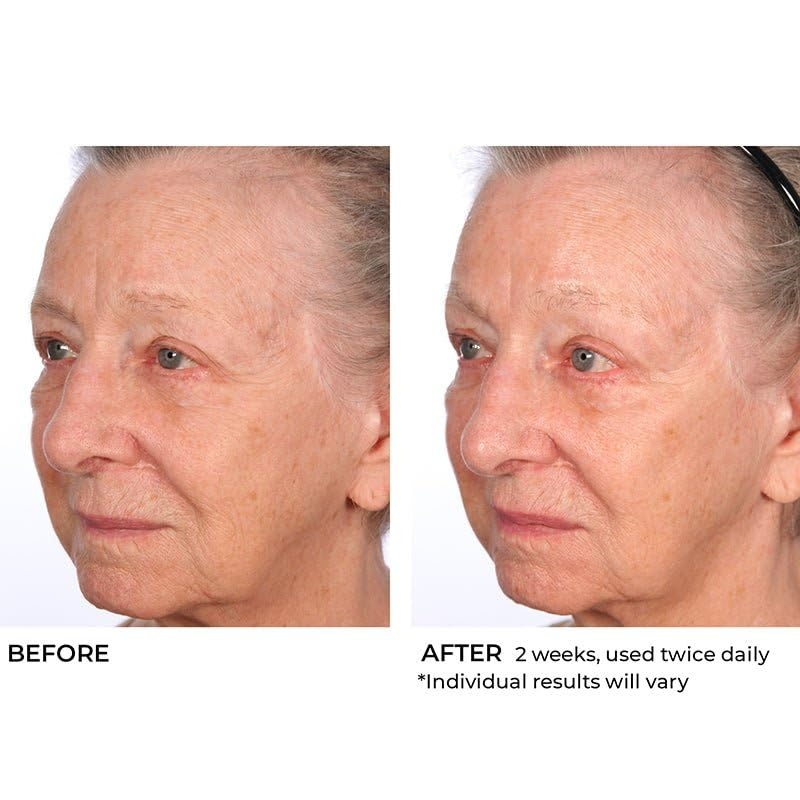 image:imageNassifMD HydroScreen Intense Hydration Face And Body SouffleJar
