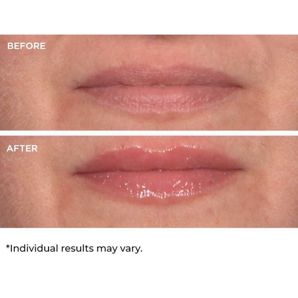 image:imageNassifMD HydroScreen for Lips Pink Champagne