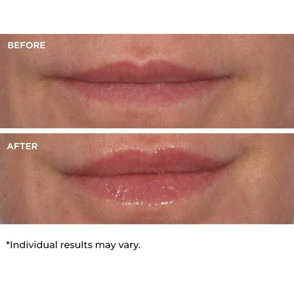 image:imageNassifMD HydroScreen for Lips Pink Champagne