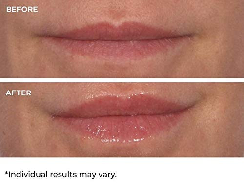 image:imageNassifMD HydroScreen for Lips