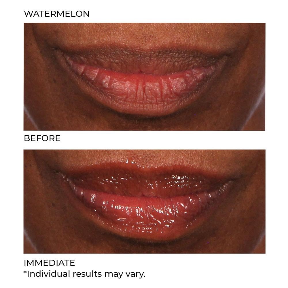 image:imageNassifMD HydroScreen for Lips