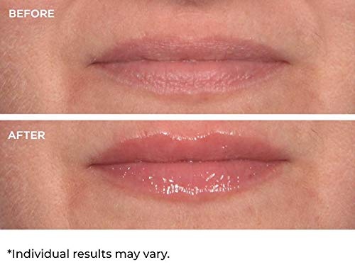 image:imageNassifMD HydroScreen for Lips