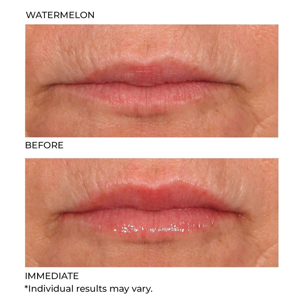 image:imageNassifMD HydroScreen for Lips