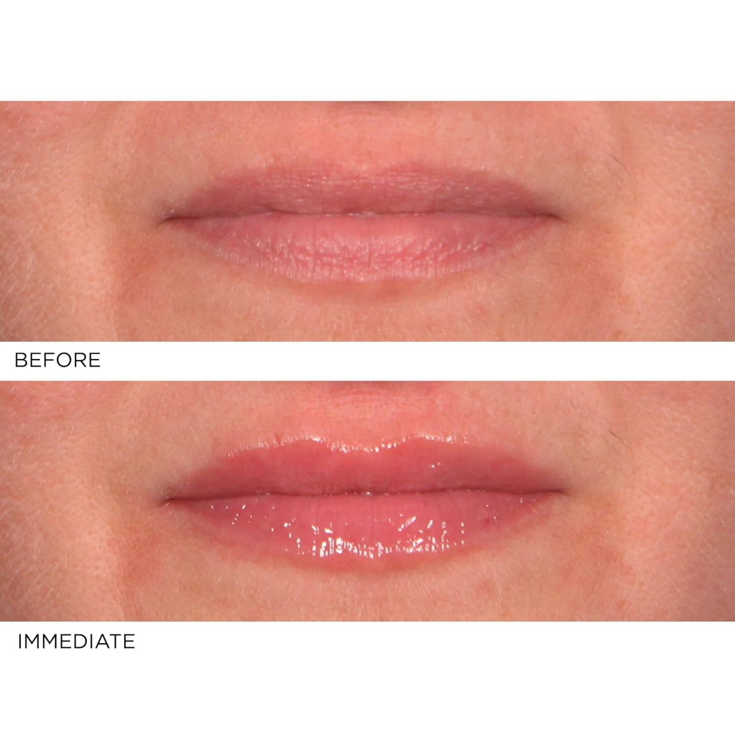 image:imageNassifMD HydroScreen with Hyaluronic Acid Lip Pluming Oil Formula for Dry Lips Hydrating Softening Lip Maximizing Serum Ceramide Jojoba Glaze Gloss