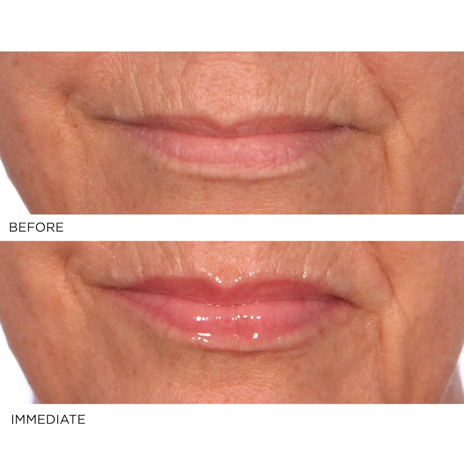 image:imageNassifMD HydroScreen with Hyaluronic Acid Lip Pluming Oil Formula for Dry Lips Hydrating Softening Lip Maximizing Serum Ceramide Jojoba Glaze Gloss