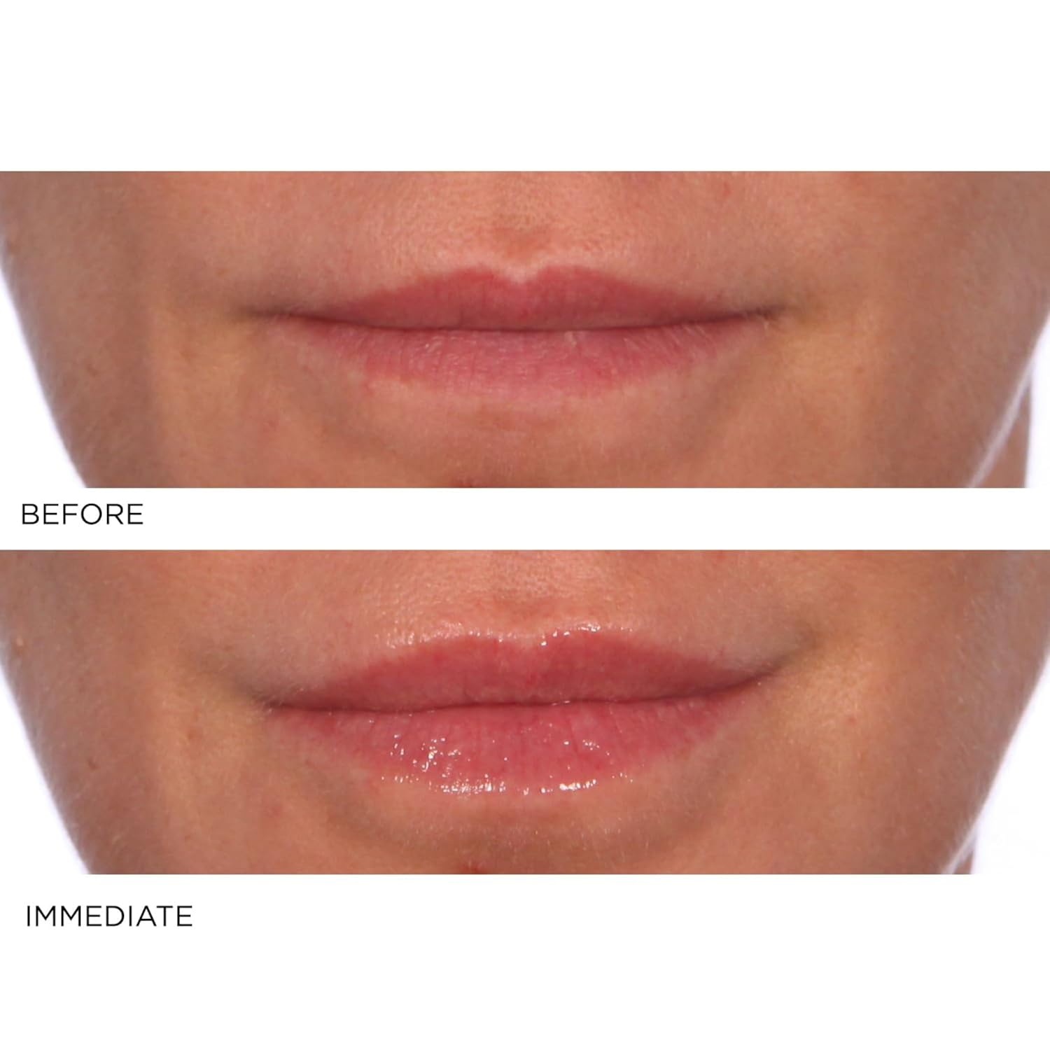 image:imageNassifMD HydroScreen with Hyaluronic Acid Lip Pluming Oil Formula for Dry Lips Hydrating Softening Lip Maximizing Serum Ceramide Jojoba Glaze Gloss