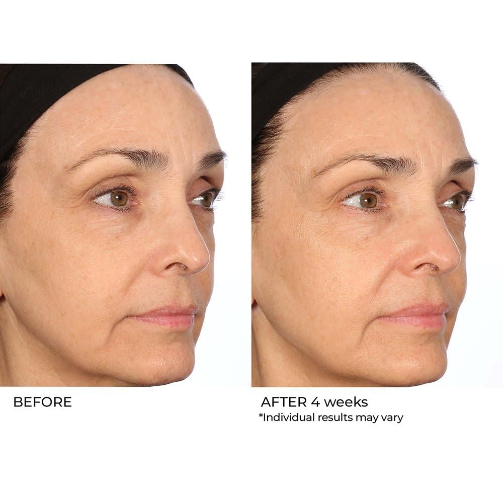 image:imageNassifMD Pro Peptide Collagen Serum Clinical Grade with Premium Ingredients for Hydrated Smooth Skin Lightweight FastAbsorbing AntiAging Formula for Softer Texture and Healthy Glow 1 oz