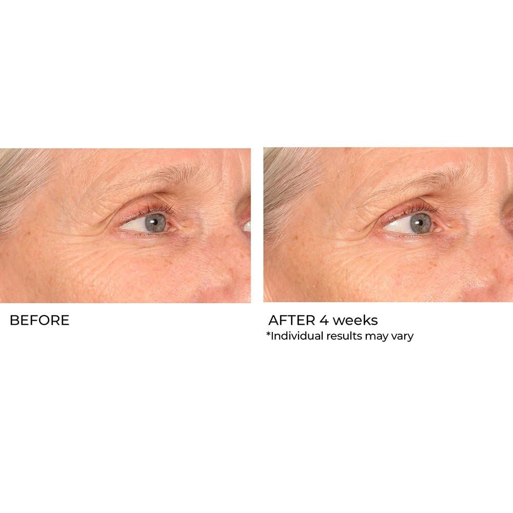 image:imageNassifMD Pro Peptide Collagen Serum Clinical Grade with Premium Ingredients for Hydrated Smooth Skin Lightweight FastAbsorbing AntiAging Formula for Softer Texture and Healthy Glow 1 oz