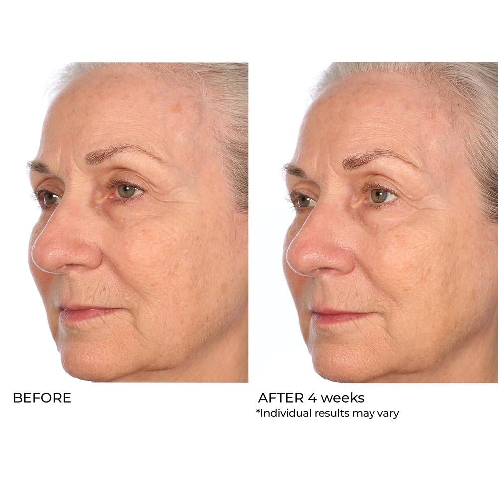 image:imageNassifMD Pro Peptide Collagen Serum Clinical Grade with Premium Ingredients for Hydrated Smooth Skin Lightweight FastAbsorbing AntiAging Formula for Softer Texture and Healthy Glow 1 oz