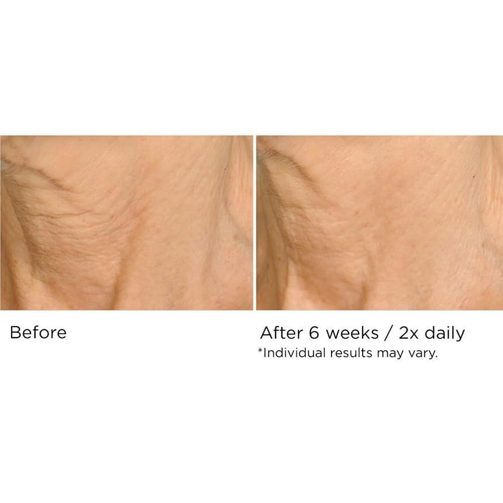 image:imageNASSIFMD DecoLift Neck amp Decollete Firming amp Lifting Complex169 Fl Oz Pack of 1