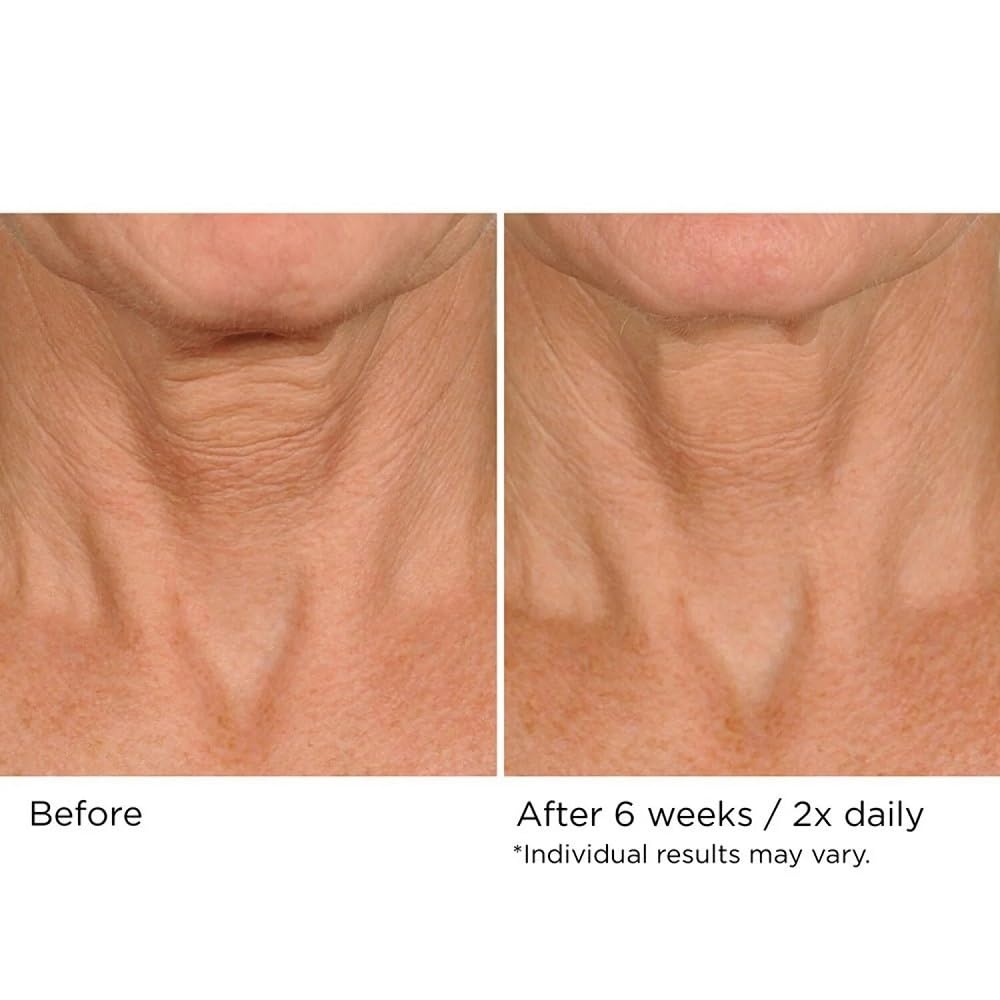 image:imageNASSIFMD DecoLift Neck amp Decollete Firming amp Lifting Complex169 Fl Oz Pack of 1