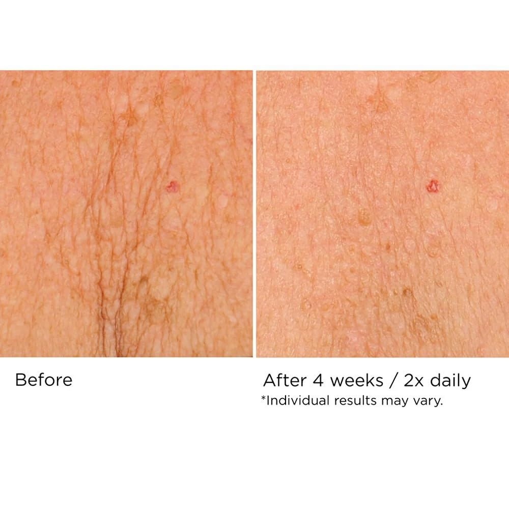 image:imageNASSIFMD DecoLift Neck amp Decollete Firming amp Lifting Complex169 Fl Oz Pack of 1