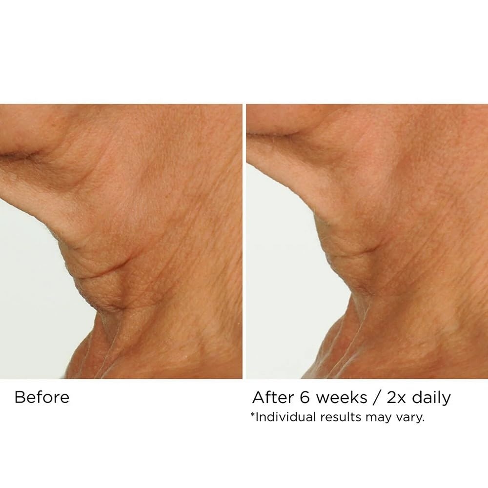 image:imageNASSIFMD DecoLift Neck amp Decollete Firming amp Lifting Complex169 Fl Oz Pack of 1